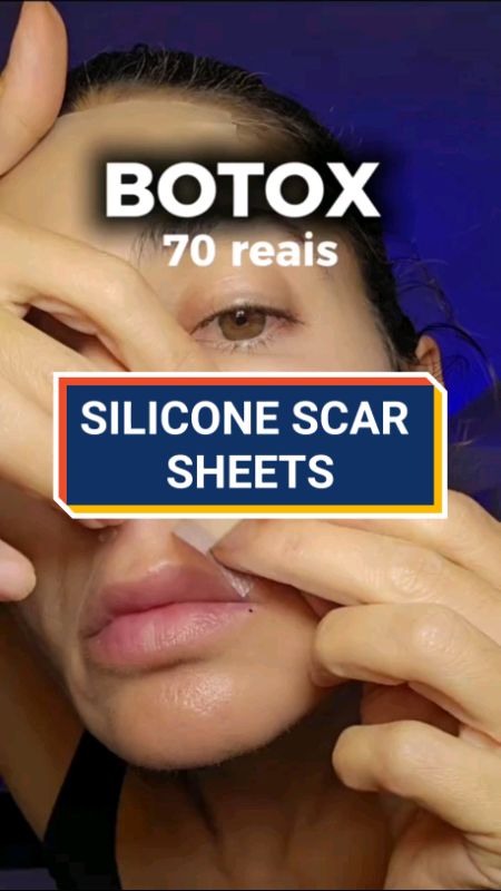 #SILICONE SCAR SHEETS